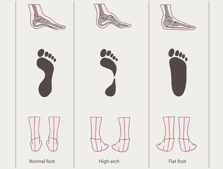 Πελματογράφημα Βασιλική Κανάκη.