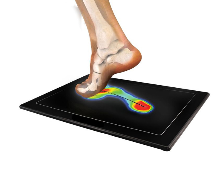 Πελματογράφημα Βασιλική Κανάκη.