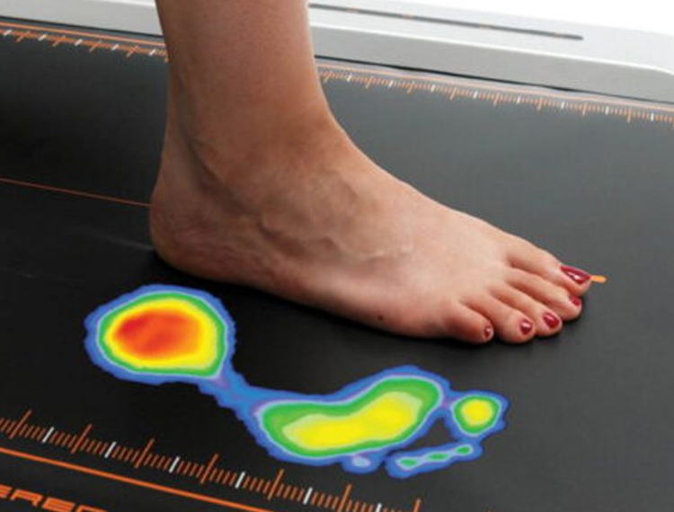 Πελματογράφημα Βασιλική Κανάκη.