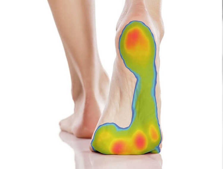 Πελματογράφημα.