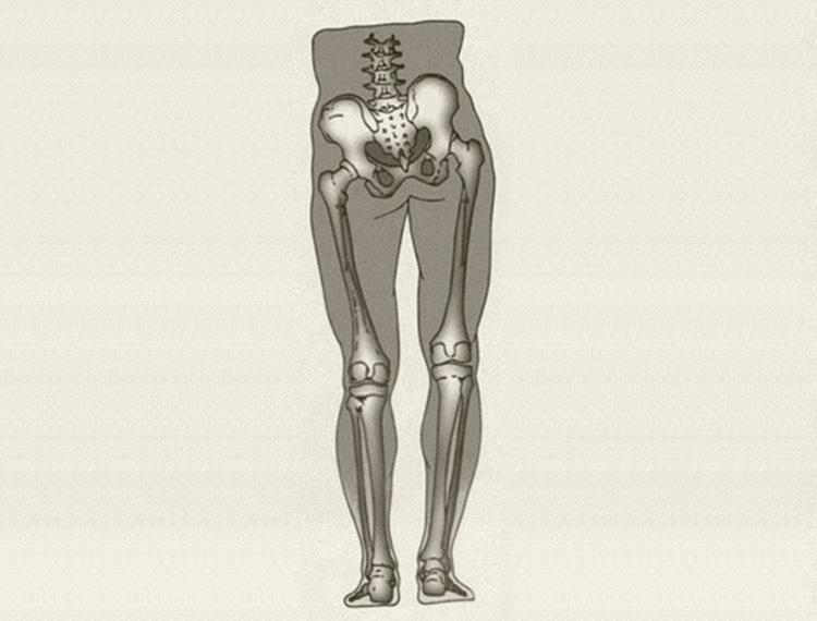 Ανισοσκελία